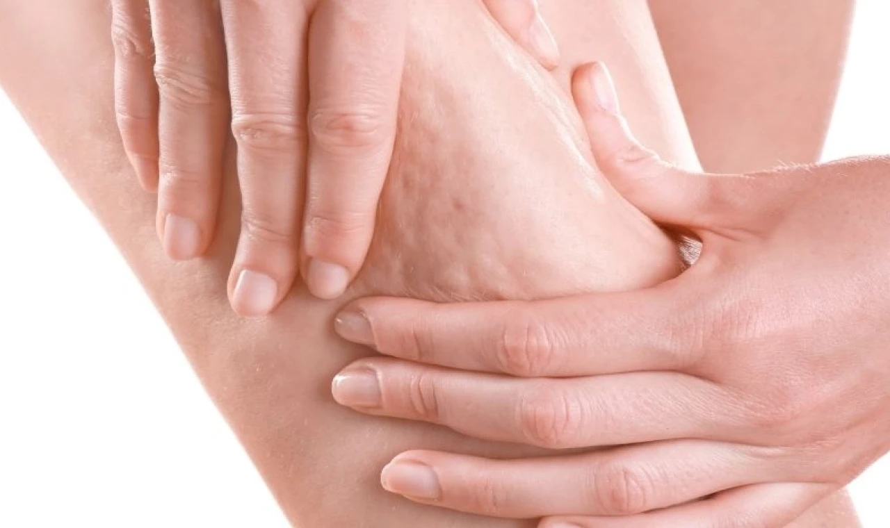 Portakal kabuğu görüntüsü basit sorun değil!