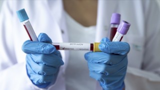 Fenerbahçe'de Kovid-19 vakaları artıyor