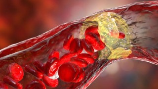 İyisiyle kötüsüyle kolesterol